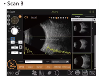Retiwave 1000 máquina de ultrasonido oftálmico a Scan Oftalmología AB Scanner
