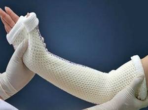 Medische Bandage Voor Chirurgische Orthopedische Pleisters En Verbanden Professionele Orthopedische Mouw Casting Tape - Product Image 5