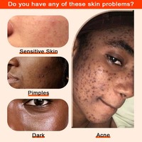 Savon éclaircissant et nettoyant rapide OEM fait main au curcuma, correcteur de taches sombres sur les jointures, savon en barre blanchissant à l'acide kojique pour tous types de peau