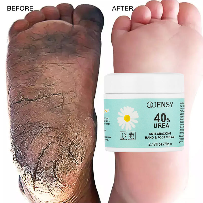 Cracked Heels Cream Intensive Foot Care Solutions