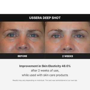 MEDICUBE AGE-R USSERA DEEP SHOT 176.4g - Masseur facial pour lifting à domicile avec prise EU - Appareil de beauté anti-âge coréen - Product Image 5