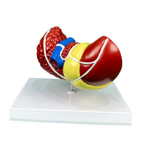 Modèle d'anatomie hépatique pathologique Structure hépatique malade avec cirrhose et lésions tumorales pour l'enseignement médical et la formation chirurgicale - Product Image 5