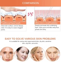 6 en 1 Pour Les Pores Du Visage Vide Nettoyant Hydro Dermabrasion Aqua Peeling Peau de Jet D'oxygène De L'eau De Rajeunissement Du Visage Machine de Beauté