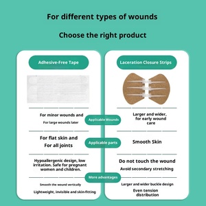 Cinta Adhesiva Médica sin Costuras <span class=keywords><strong>para</strong></span> <span class=keywords><strong>Cerrar</strong></span> <span class=keywords><strong>Heridas</strong></span>, Reducir Cicatrices, Transpirable, Certificada CE, 6cm*100m, Desinfectante con Ozono - Product Image 3