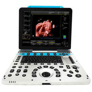Alat diagnostik ultrasonik warna 3D/4D/5D, pemindai Ultrasound eksklusif portabel, peralatan Ultrasound - Product Image 1
