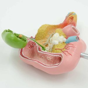 Model Pancreas, Duodenum, dan Kandung Empedu Manusia Ukuran Asli KyrenMed dengan Pembuluh Darah & Saraf - Product Image 3