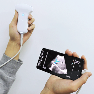 Không dây siêu âm đầu dò tuyến tính thăm dò mslpu79 - Product Image 1