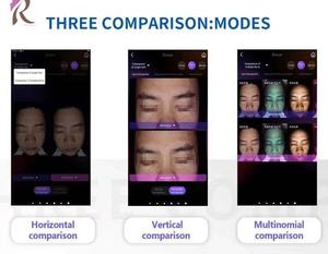 Bitmoji A6 mesin Diagnosis kesehatan, penganalisis kulit Digital cerdas AI warna kulit tes kesehatan - Product Image 3
