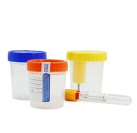 Recipiente de taza de recolección de orina al vacío estéril, taza de muestra médica para recolección de muestras de orina, taza de orina al vacío estéril