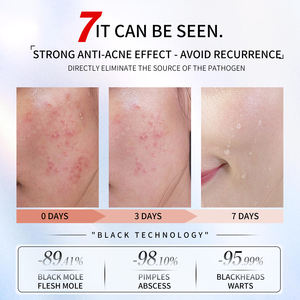 Dispositivo de Belleza de Ondas Magnéticas de Escritorio - Blanqueamiento de Piel en un Segundo, Eliminación de <span class=keywords><strong>Tatuajes</strong></span>, Rejuvenecimiento Facial y Corporal, Purificación - Product Image 4