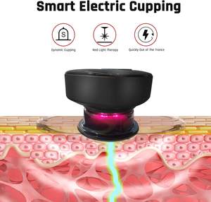 निम्न आय वर्ग बिजली शारीरिक Cupping उपकरण ब्लू वैक्यूम सिलिकॉन Cupping उपकरण सेट स्मार्ट चिकित्सा मालिश चषक प्रयोग मशीन - Product Image 2