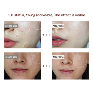 Meiboyi Hot Sell Gesichts reinigungs gerät Sauerstoff Nano Mist Sprayer Heimgebrauch Beauty Salon Ausrüstung - Product Image 6