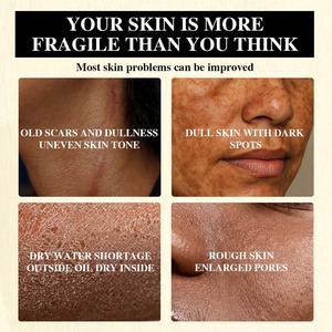 Sérum éclaircissant naturel <span class=keywords><strong>anti</strong></span>-taches pour la peau, élimine la pigmentation, avec collagène, vitamine Gluta pour peaux noires - Product Image 3