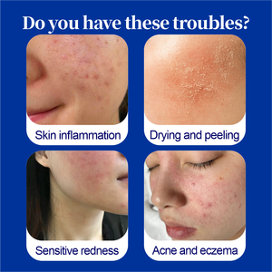 Gel Médico para el Cuidado de la Piel de Alta Calidad y Bajo Costo, la Mejor Ungüento para Cortes en la Piel, Tratamiento Facial, Rehabilitación y Terapia - Product Image 2