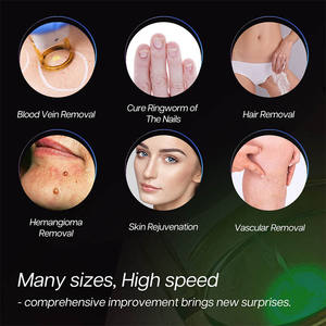 Máquina de Depilación Láser Alexandrite 755Nm 1064Nm Nd Yag, 4000W, Tecnología Alex, en Venta - Product Image 4