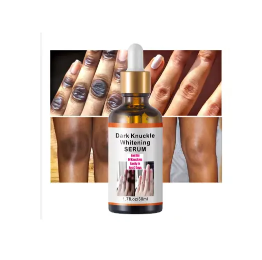MOIKA özel etiket 50ml 7 gün beyazlatma koyu Knuckle C vitamini Dispelling siyah vücut Serum beyazlatma özü