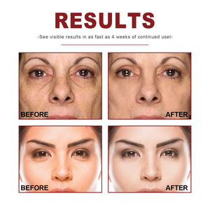 Sérum pour le visage Jaysuing raffermissant, liftant, hydratant, anti-rides, réparateur, collagène, rétinol, vitamine <span class=keywords><strong>B3</strong></span> - Product Image 5