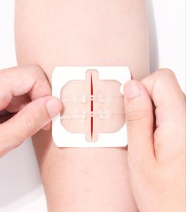 Dispositivo Portátil con Cierre de Cremallera, Tira Elástica Selladora, Grapadora de Heridas para Exteriores, Herramienta de Primeros Auxilios Médica de Emergencia Personalizada - Product Image 1