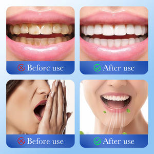 Mondverzorging Tandpasta Whitening Baking Soda Gember Groene Munt Propolis Mint Voor Vlekverwijdering Tanden Verhelderen Thuis - Product Image 4