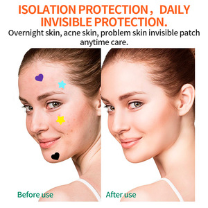 Patchs anti-acné en forme d'étoile 10 mm 10 pièces Traitement de l'acné pour adultes - Product Image 5