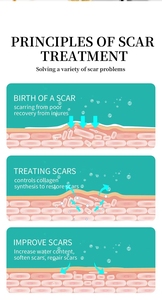 Crema Aclaradora para la Piel Postoperatoria para Quemaduras 50g Transfronteriza - Product Image 6