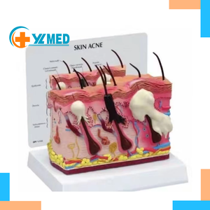 Modello anatomico della pelle umana per la biologia oggetto di metallo modello di occhio per <span class=keywords><strong>le</strong></span> scuole per gli ospedali modello di insegnamento di scienza medica Acne - Product Image 1