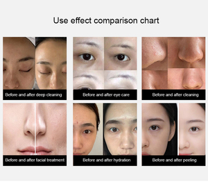 Máquina de hidrodermoabrasión promocional 14 en 1, chorro de oxígeno, cabezal de agua, microdermoabrasión de belleza - Product Image 3