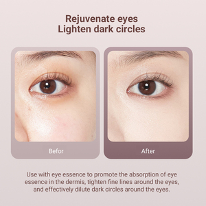 Peralatan pijat galvanis penghilang keriput anti-penuaan, mesin Perawatan Mata pintar, instrumen pijat mata - Product Image 5