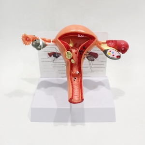 Modelo de Órganos Reproductores Femeninos, Útero, Ovario, Vagina, Modelo Anatómico Patológico, Ayuda Didáctica de Ginecología, PVC, Anatomía Detallada - Product Image 1