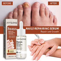 Sérum pour ongles JAYSUING, réparation et croissance efficaces des ongles, traitement antifongique des ongles en 7 jours