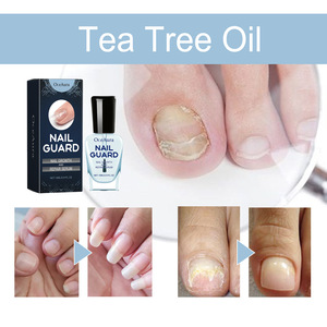 Soin des ongles et des pieds contre les mycoses, traitement <span class=keywords><strong>antifongique</strong></span> pour les ongles, essence anti-infection pour l'onychomycose des orteils - Product Image 4
