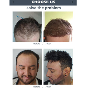 Franges pour hommes, toupet naturel <span class=keywords><strong>avec</strong></span> <span class=keywords><strong>frange</strong></span>, ligne frontale en pu, <span class=keywords><strong>cheveux</strong></span> humains indiens, offre spéciale - Product Image 5