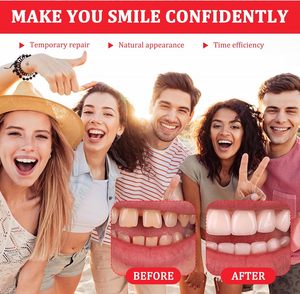 4 Kits de Dents Prothétiques en Résine Acrylique, Supérieures et Inférieures, Couronnes Temporaires, Kit de Remplacement, Un Ensemble de Dents Simulées pour Cosplay - Product Image 5
