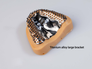 Machine de fabrication et de polissage CNC pour implants dentaires, aligneurs, couronnes, pièces métalliques, usinage par coulée, électropolissage et polissage en laboratoire - Product Image 5