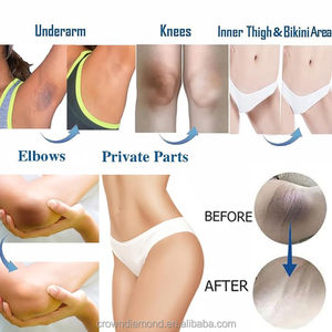 Hàn Quốc tự nhiên Vegan Alpha Arbutin Dark Knuckle loại bỏ sắc tố ngay lập tức làm trắng tàn nhang sáng cơ thể chăm sóc da mặt Kem - Product Image 3