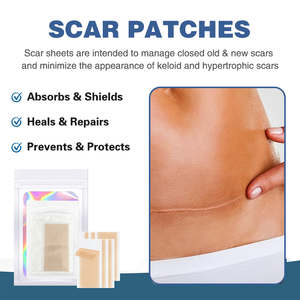 Feuilles de <span class=keywords><strong>silicone</strong></span> avancées pour cicatrices, feuilles professionnelles pour l'élimination des cicatrices, améliore l'apparence des cicatrices anciennes et récentes dues aux blessures, aux brûlures et aux interventions chirurgicales - Product Image 2