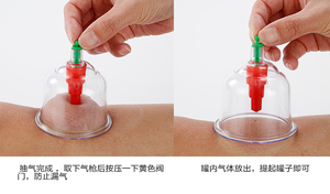 Juego de Ventosas de vacío chinas, juego de ventosas de 12 piezas - Product Image 5