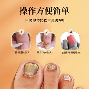 Solución OEM para el Tratamiento de Onicomicosis, Cuidado Antibacteriano de Uñas para Manos y Pies, Reparación de Daños, Especificaciones Normales - Product Image 4