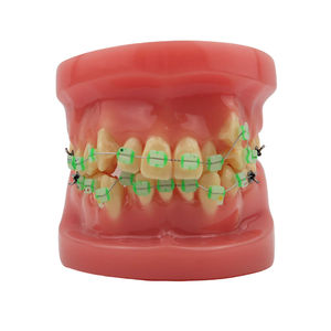 Modelo de Demostración de Ortodoncia para Educación Dental con 28 Piezas de Dientes y Brackets de Cerámica - Product Image 2
