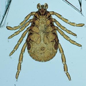 Juego de Portaobjetos Preparados para Microscopio, con Muestras de Parásitos, Garrapatas, Mosquitos y Gusanos, para Enseñanza Biológica y Observación en Laboratorio - Product Image 4
