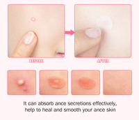 Marque privée tache de peau bouton d'acné patch d'imperfections bouton clair