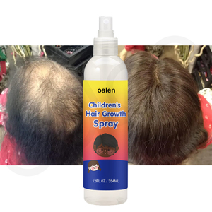 <span class=keywords><strong>Spray</strong></span> para el Crecimiento del Cabello para Niños de Marca Privada, Tratamiento Orgánico Natural para el Cuero Cabelludo, Sin Enjuague, Estimula el Cabello Fuerte y Saludable para Niños - Product Image 2