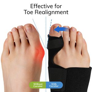 Correcteur d'<span class=keywords><strong>Hallux</strong></span> <span class=keywords><strong>Valgus</strong></span> Réglable, Redresseur d'Orteils, Soulagement de la Douleur au Pied, <span class=keywords><strong>Attelle</strong></span> de Soutien Nocturne, <span class=keywords><strong>Attelle</strong></span> pour <span class=keywords><strong>Hallux</strong></span> <span class=keywords><strong>Valgus</strong></span> - Product Image 6