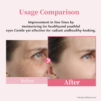 Crème Contour des Yeux PDRN au Collagène avec Caféine, Niacinamide, Triple Peptide et Huile de Jojoba pour Yeux Gonflés – Vente en Gros, Marque Privée, Soin de la Peau OEM