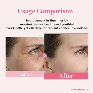 Crème Contour des Yeux PDRN au Collagène avec Caféine, Niacinamide, Triple Peptide et Huile de Jojoba pour Yeux Gonflés – Vente en Gros, Marque Privée, Soin de la Peau OEM - Product Image 6