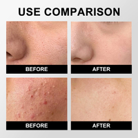 CHIC BEAUTE Solution tonifiante à l'acide glycolique 7% Exfoliation douce Peau claire Réduit les pores Élimine l'acné Éclaircit la peau Sérum facial