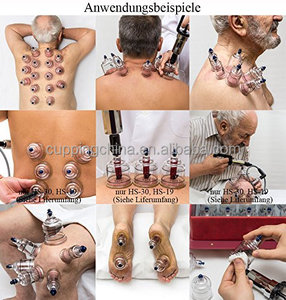 <span class=keywords><strong>Hansol</strong></span> perlengkapan bekam vakum plastik 19 buah, Set bekam aplikasi tubuh - Product Image 3