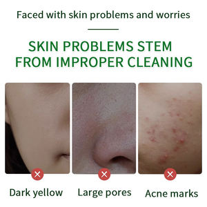 น้ำยาทำความสะอาดผิวหน้าจากธรรมชาติ ลดสิว บำรุงผิว <span class=keywords><strong>ช่วย</strong></span>ทำความสะอาดรูขุมขนอย่างอ่อนโยน ด้วยกรดไฮยาลูโรนิกและ <span class=keywords><strong>BHA</strong></span> ผลิตภัณฑ์บำรุงผิวสไตล์เกาหลี - Product Image 4