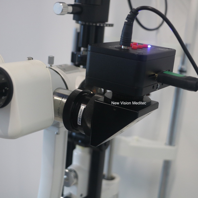 Digital Solutions for Zeiss, Alcon, Moller, Takagi, Topcon Microscope