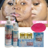 Dissolvant correcteur pour taches brunes marque privée pour la peau foncée estompe les taches noires hyperpigmentation clarifier la beauté africaine ensemble de soins de la peau